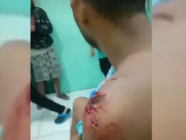 Warga Desa Delas diterkam Buaya